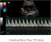 Analizzatore portatile ultrasonico di ultrasuono del dispositivo diagnostico di Ipad con stoccaggio di immagine 500G