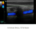 Analizzatore portatile di ultrasuono dell'attrezzatura di ricerca di ultrasuono con frequenza 2. 0MHz~10. 0MHz della sonda
