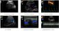 Analizzatore portatile di ultrasuono della macchina di ricerca di ultrasuono con profondità 320mm di esame