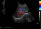 Sonda cardiaca portatile dell'analizzatore 4D di UItrasound dell'analizzatore di ultrasuono di Digital facoltativa