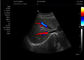 Attrezzatura portatile di ultrasuono dell'analizzatore 4d di ultrasuono della macchina medica di ultrasuono