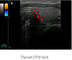 Analizzatore portatile di ultrasuono dell'unità portatile di ultrasuono con peso 3D facoltativo e 5.5Kgs