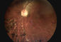 3,5&quot; attrezzatura diagnostica di oftalmologia per il diabete di glaucoma