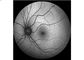 Attrezzatura oftalmica di Angiograph Digital 160° della retina