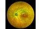 Attrezzatura oftalmica di Angiograph Digital 160° della retina