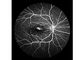 Attrezzatura oftalmica professionale della macchina fotografica del fondo di esame del laser con la dimensione minima dell'allievo di FOV 160° di rappresentazione del fondo 2 millimetri
