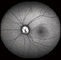 Macchina fotografica confocale del fondo di Opthalmoscope Digital della retina con FOV 15°, 30°, 60° dimensioni immagine 1024*1024