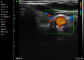 Applicazione vascolare addominale di ginecologia di pediatria di ultrasuono di Ipad dell'analizzatore di doppler portatile tenuto in mano di colore