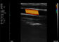 Echo Handheld Color Doppler Linear esplora la frequenza dell'arteria carotica 7.5-10MHz