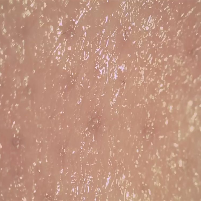 Analizzatore senza fili della pelle di Digital del rivelatore dell'umidità della pelle per osservare superficie dei pori di Derm della pelle