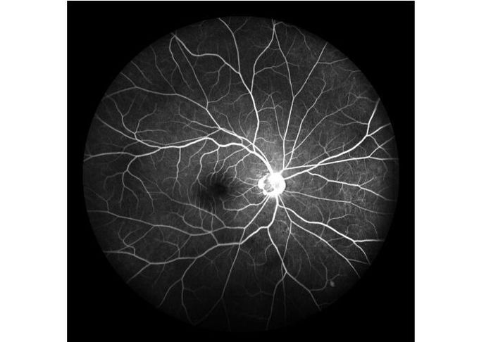 attrezzatura oftalmica Ultra di ampiezza di Angiograph Digital della retina di esame del laser del campo con lo zoom ottico 100°/60°/30°