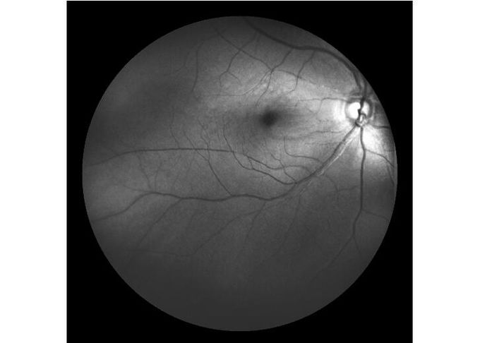 attrezzatura oftalmica Ultra di ampiezza di Angiograph Digital della retina di esame del laser del campo con lo zoom ottico 100°/60°/30°