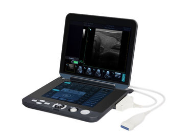 Analizzatore portatile di ultrasuono di Digital di stoccaggio permanente di 128 immagini con lo schermo a 12 pollici del LED