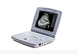 Analizzatore portatile di ultrasuono del bambino della macchina portatile di ultrasuono per pediatria