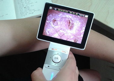 Analisi tenuta in mano video Dermatoscope dei capelli e della pelle con il LCD variopinto a 3.5 pollici