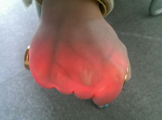 Alluminio dorato del proiettore di iniezione in vena della vena del cercatore dell'indicatore di posizione infrarosso vascolare portatile della vena