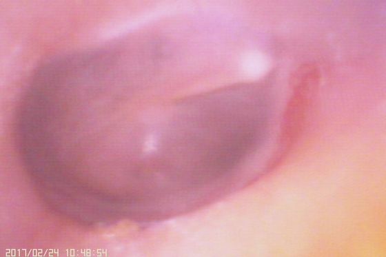 Otoscopio video digitale 720X480