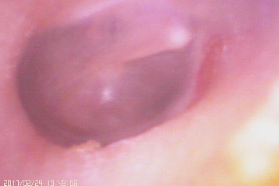 Otoscopio video digitale 720X480