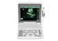 Attrezzatura medica mobile portatile BIO- 3000J dall'analizzatore di ultrasuono del computer portatile di Digital con lo schermo a 1,12 pollici del LED