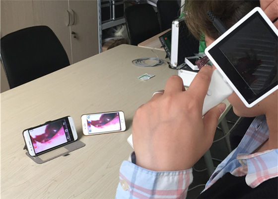 Otoscopio video digitale 720X480