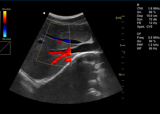 Ultrasuono portatile di rappresentazione di doppler di Digital di colore della macchina piena a 15 pollici di doppler con porta USB 2