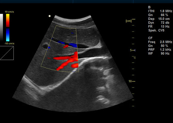 Ultrasuono portatile di rappresentazione di doppler di Digital di colore della macchina piena a 15 pollici di doppler con porta USB 2