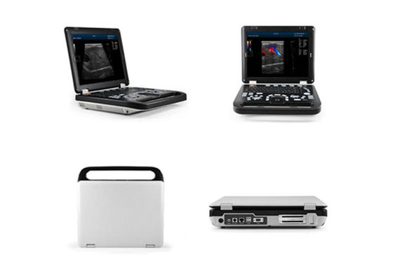 Analizzatore umano diagnostico a 15 pollici di ultrasuono della macchina di doppler di colore del LED con un collegamento di 2 sonde