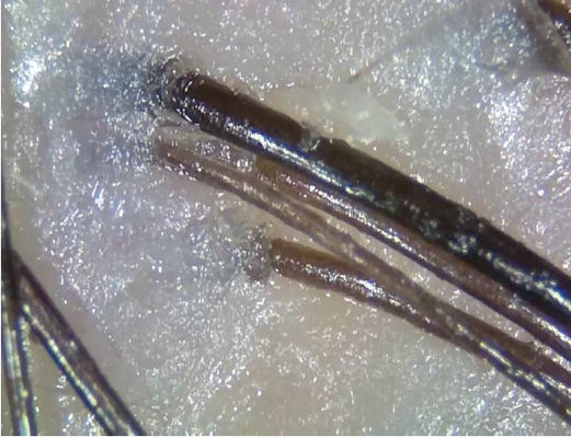 Il dispositivo senza fili portatile di diagnosi di telemedicina dell'analizzatore della pelle di Digital con polarizza la luce