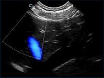 Sonda tenuta in mano di doppler di colore dell'analizzatore di ultrasuono della mini tasca variabile con frequenza di 2~11MHz