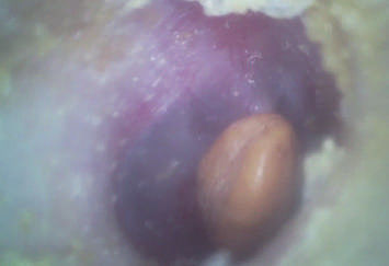 Otoscopio tenuto in mano economico di Digital di portata OTORINOLARINGOIATRICA portatile video con il micro flash card di deviazione standard di 32G