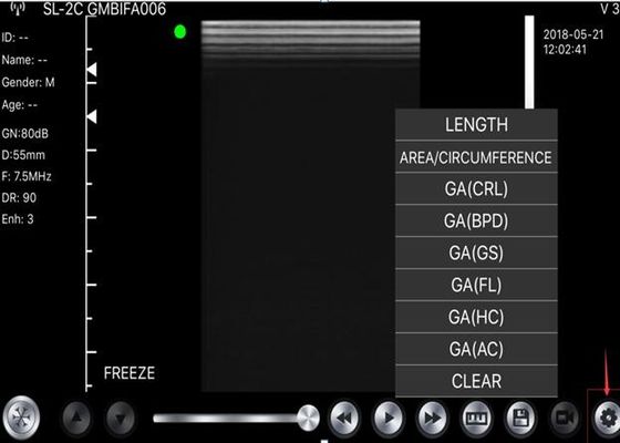 analizzatore tenuto in mano di ultrasuono 5G convesso: 3.5~5MHz, lineare: 7.5~10MHz, cardiaco: 2.5~5MHz
