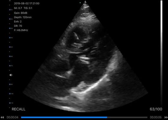 analizzatore tenuto in mano di ultrasuono 5G convesso: 3.5~5MHz, lineare: 7.5~10MHz, cardiaco: 2.5~5MHz
