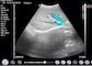 Applicazione ostetrica di pediatria di ginecologia di doppler di ultrasuono di ultrasuono tenuto in mano diagnostico portatile domestico di doppler