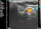 Applicazione ostetrica di pediatria di ginecologia di doppler di ultrasuono di ultrasuono tenuto in mano diagnostico portatile domestico di doppler
