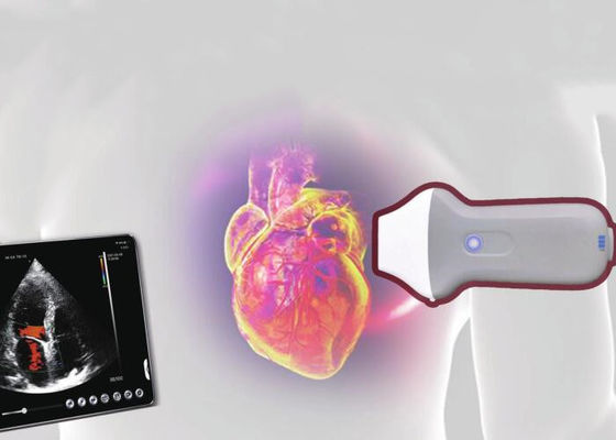 Elemento portatile senza fili dell'analizzatore 128 di ultrasuono di PDI WiFi